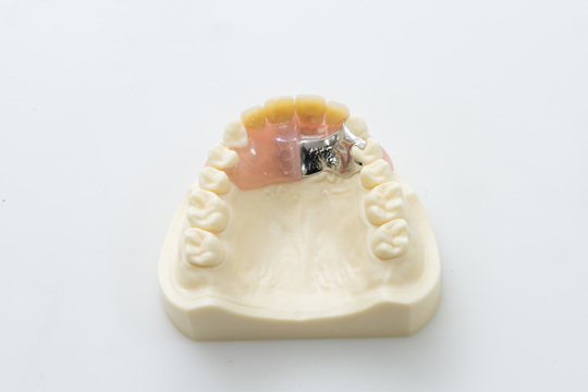 ノンクラスプデンチャー＋金属床義歯の部分入れ歯の症例「うまく話せ